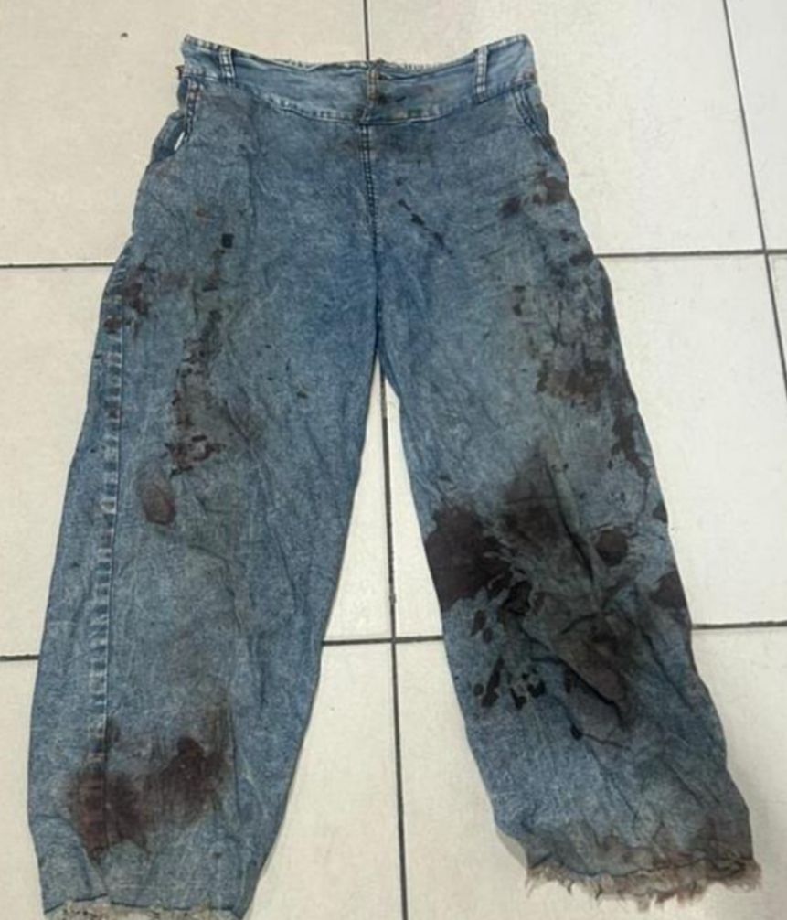 Polres Kotim Ungkap Kasus Anirat, Tersangka Penganiayaan Berat Ditangkap.